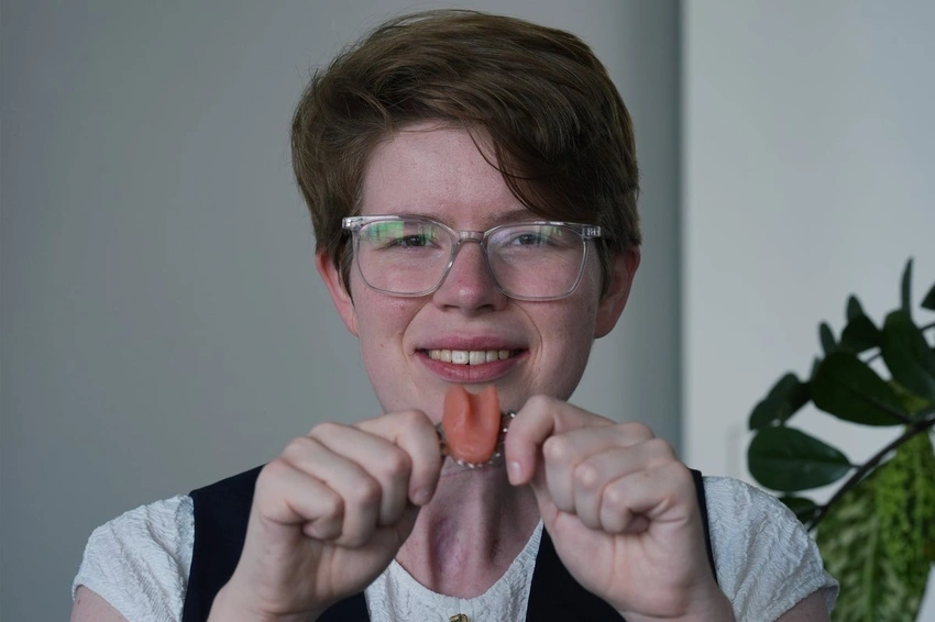 NHS First: Cancer Survivor Finds Her Voice with Bespoke Artificial Tongue