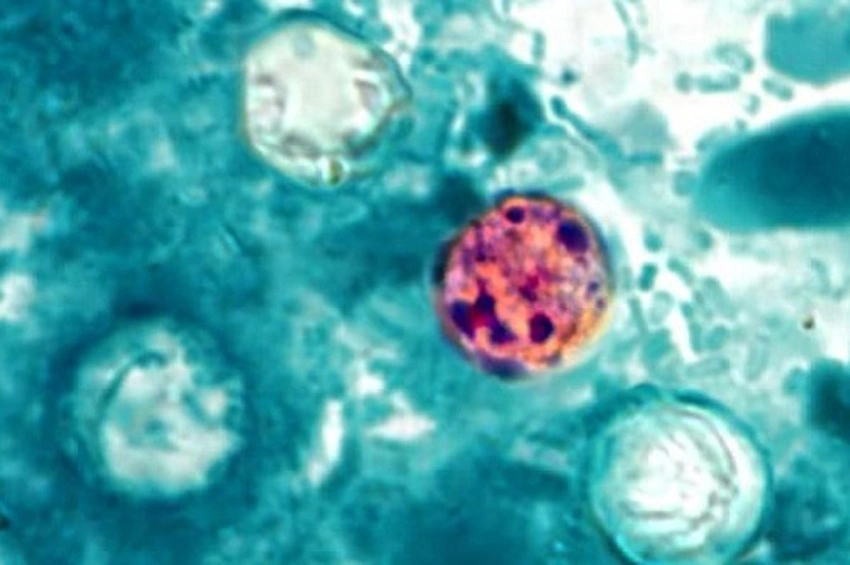 Michigan Hit by Massive "Explosive Diarrhea" Parasite Outbreak! 🦠😷