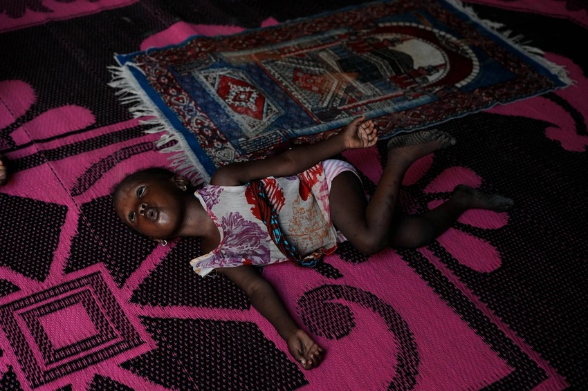Nigerian Children Face Malnutrition Crisis Amidst Iran War Fallout