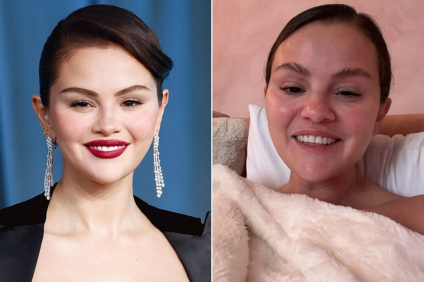 Selena Gomez Opens Up on Speculation About Her Speech and Lip Discoloration