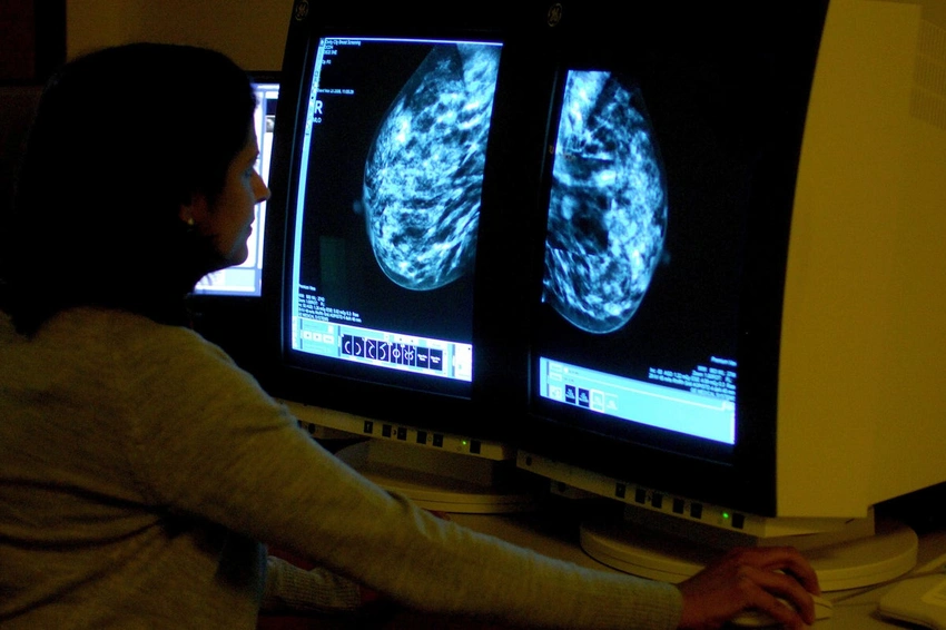 New Genomic Test Could Spare Millions of Breast Cancer Patients from Chemotherapy