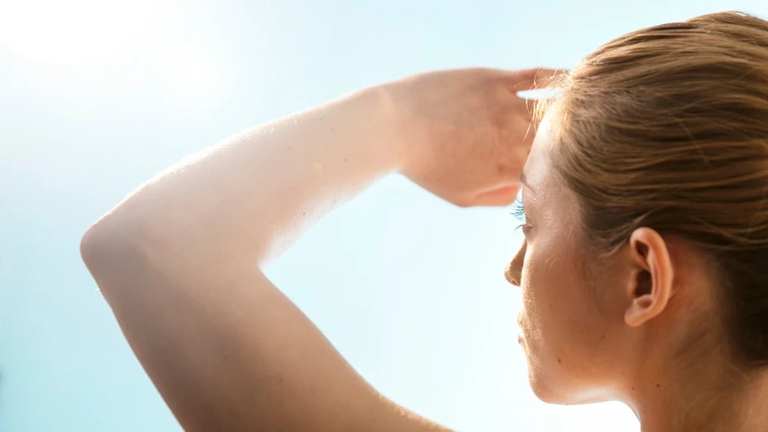 Invisible Damage: How Sun Exposure Quietly Shapes Acne Scars Over Time