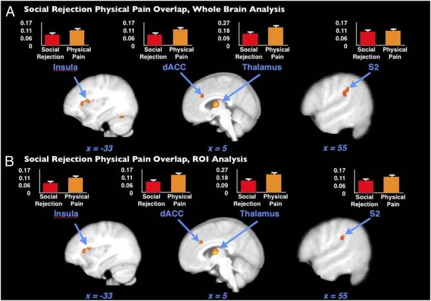 brain scan fMRI social pain physical pain
