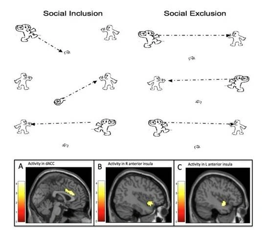 Why a Broken Heart Feels Like a Broken Bone: The Science of Social Pain