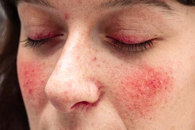 Why Less Is More: The Minimalist Approach to Skin Care for Sensitive Skin
