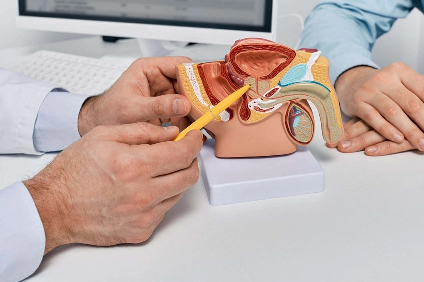 UK Experts Advise Against Mass Prostate Cancer Screening: Here’s Why