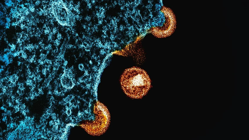 Aid cuts threaten HIV care across Africa, risking millions more infections