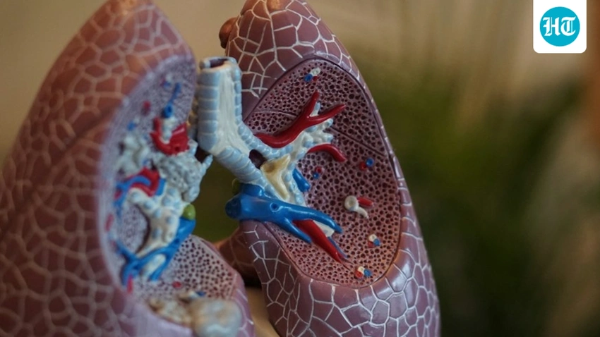 Plague Scare in Russia: Is India at Risk? Expert Weighs In!