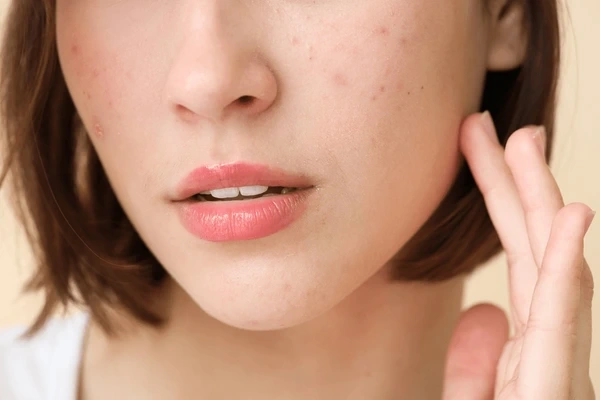 Why Your Skin Gets Used to Products: The Plateau Effect in Skincare