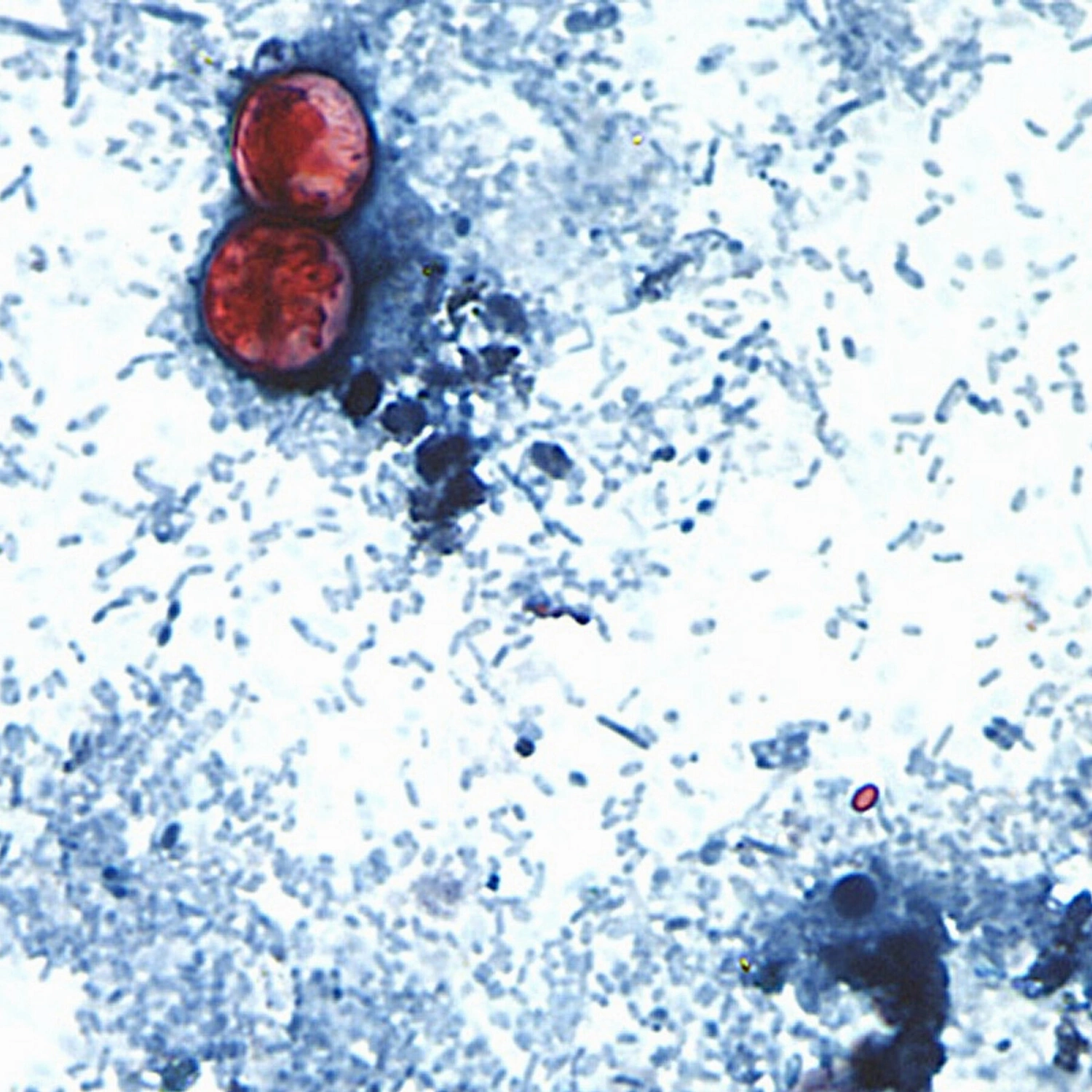 Record Cyclospora Outbreak: How Did Human Waste Infect Our Food?!
