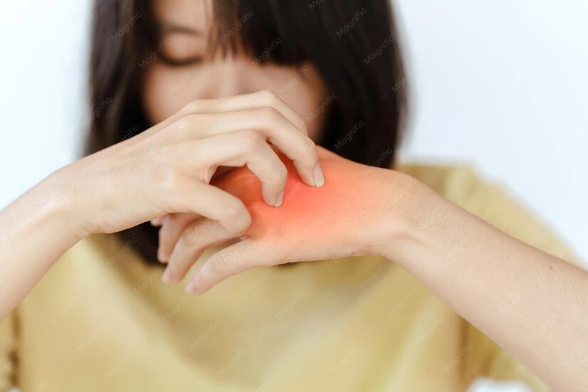 Hands scratching skin anxiety