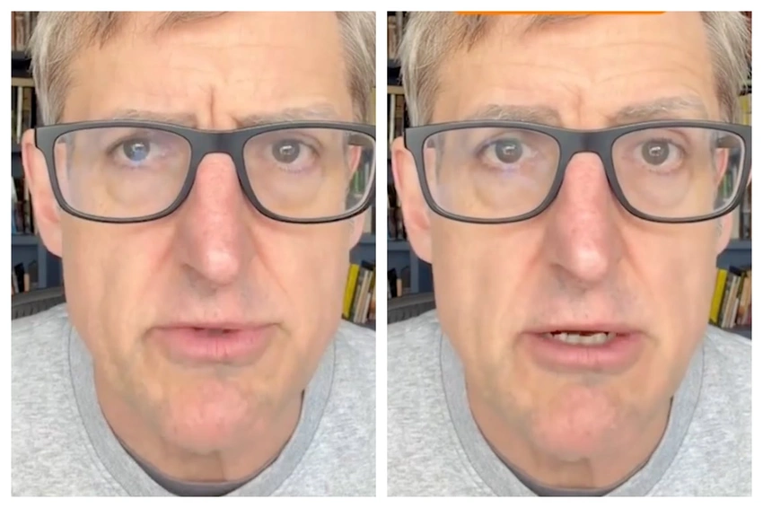 Louis Theroux updates fans on health after hair loss in Manosphere documentary