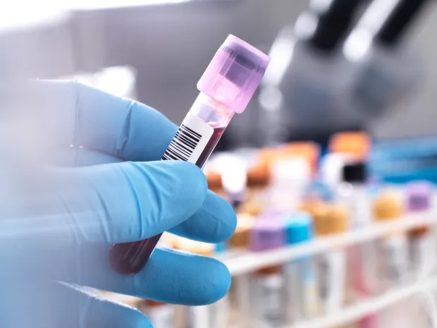 Ultra‑Rare CRIB Blood Group Found in Kolar Woman, First in the World