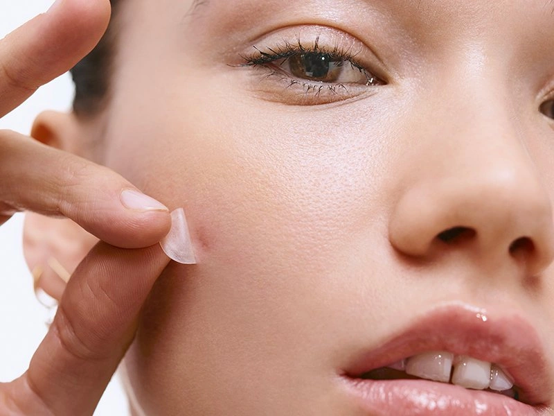The Healing Seal Effect: How Covered Acne Recovers Faster Than Exposed Breakouts