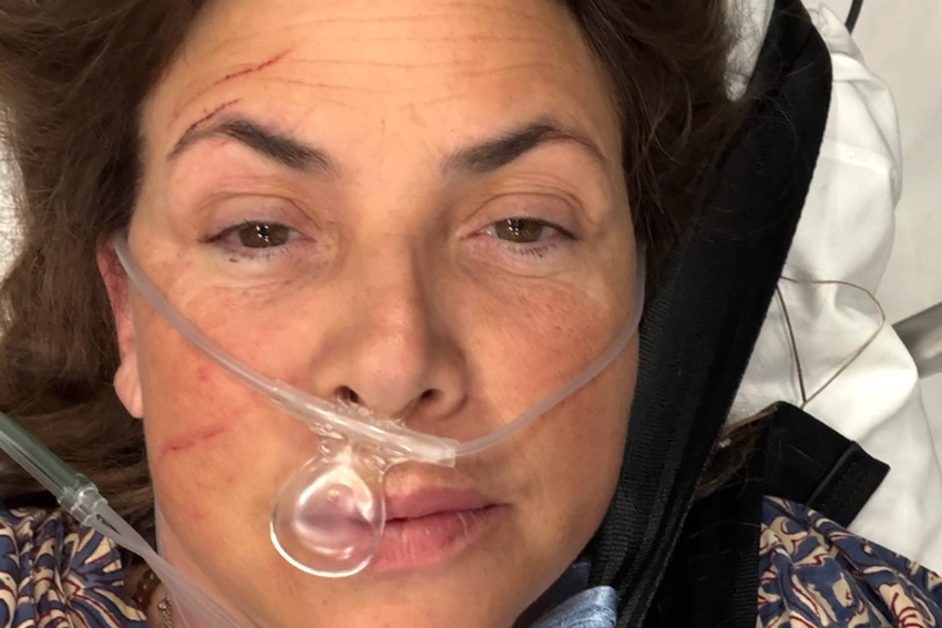 Kirstie Allsopp Airlifted After Beach Fall! Broken Leg & Birthday Drama 🚑