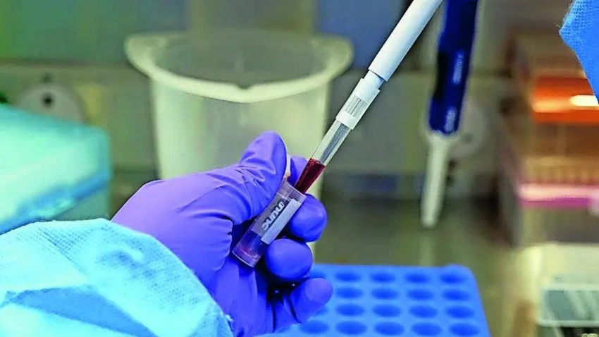 India on Alert: Airport Surveillance Ramps Up Over Suspected Ebola Cases