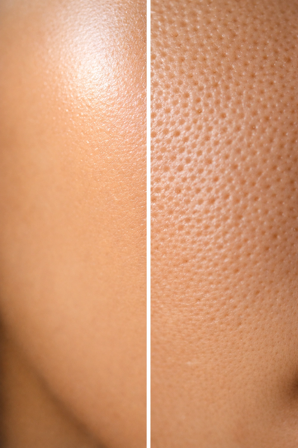 What Makes an Acne Spot Corrector Actually Work - and Which Ones Are a Waste of Money