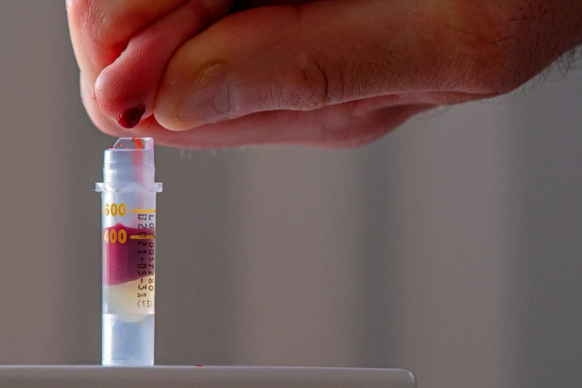 Simple Blood Test May Detect Alzheimer's Decades Before Symptoms Show