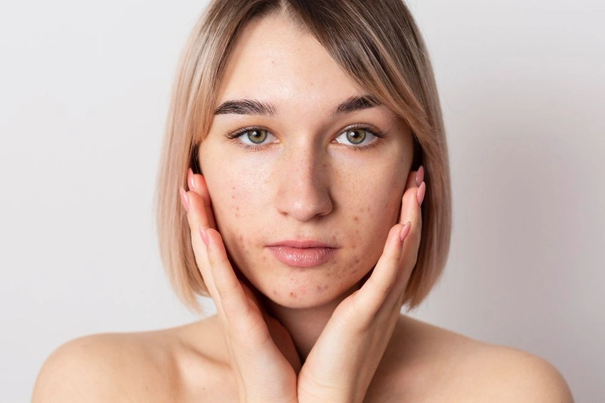 The “Invisible Congestion” Theory: Why Your Skin Feels Fine Until It Suddenly Breaks Out