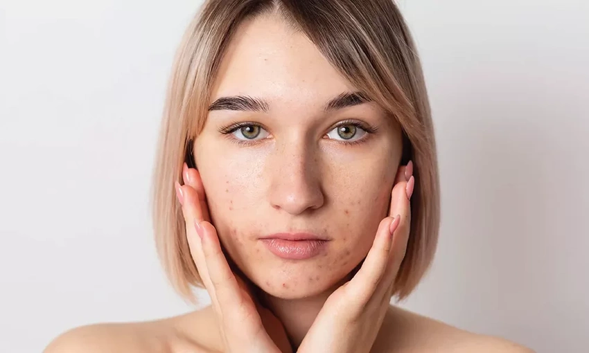 Why “Heat Aging” May Be the Skincare Problem More People Are Starting to Notice