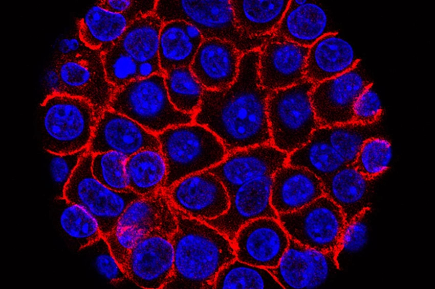 New Daily Pill Doubles Survival Time for Advanced Pancreatic Cancer