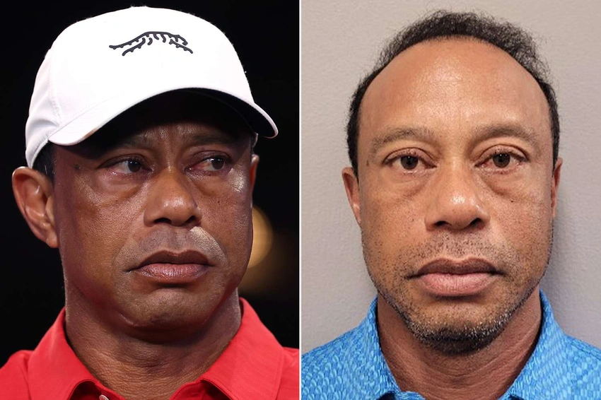 Tiger Woods Steps Away to Seek Treatment After DUI Crash