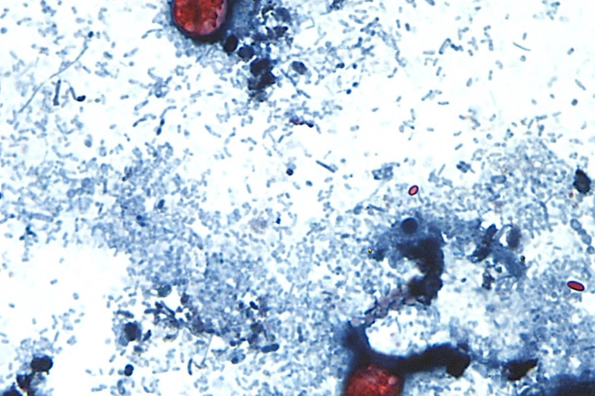 Lettuce Alert! Taylor Farms Recalls Products in 27 States Over Cyclospora Risk