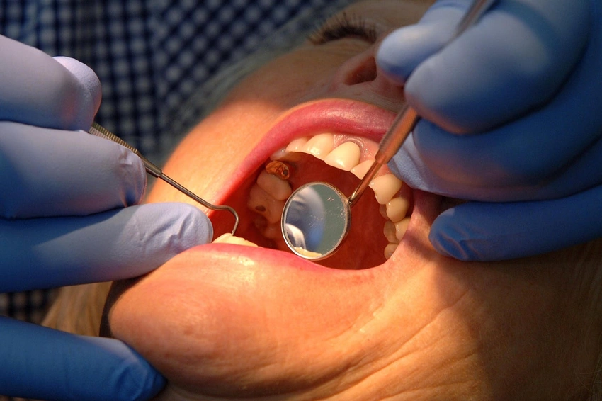 Dental Patients Face £10k Bills, 'Broken' Complaint System Exposed!