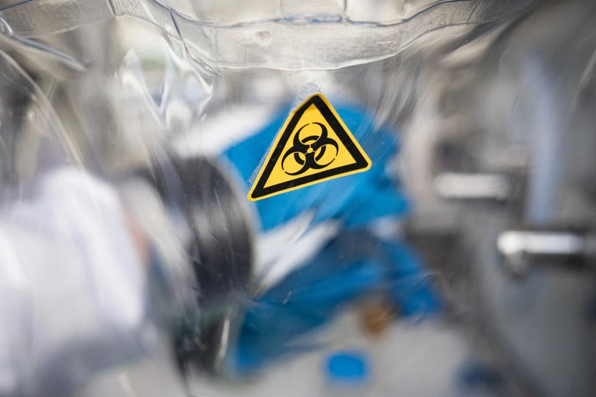 Russia on High Alert: Lab Worker Dies from Suspected Plague, 200 Quarantined