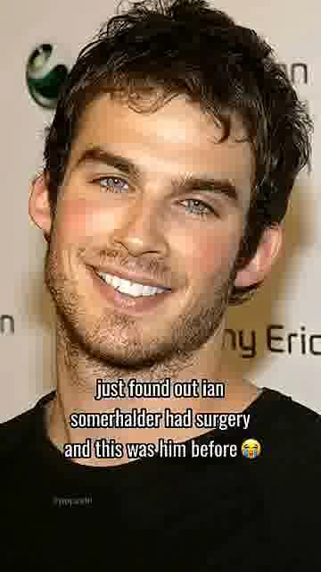 Ian somerhalder before surgery: 

Fans react after seeing Ian Somerhalder before his reported surger